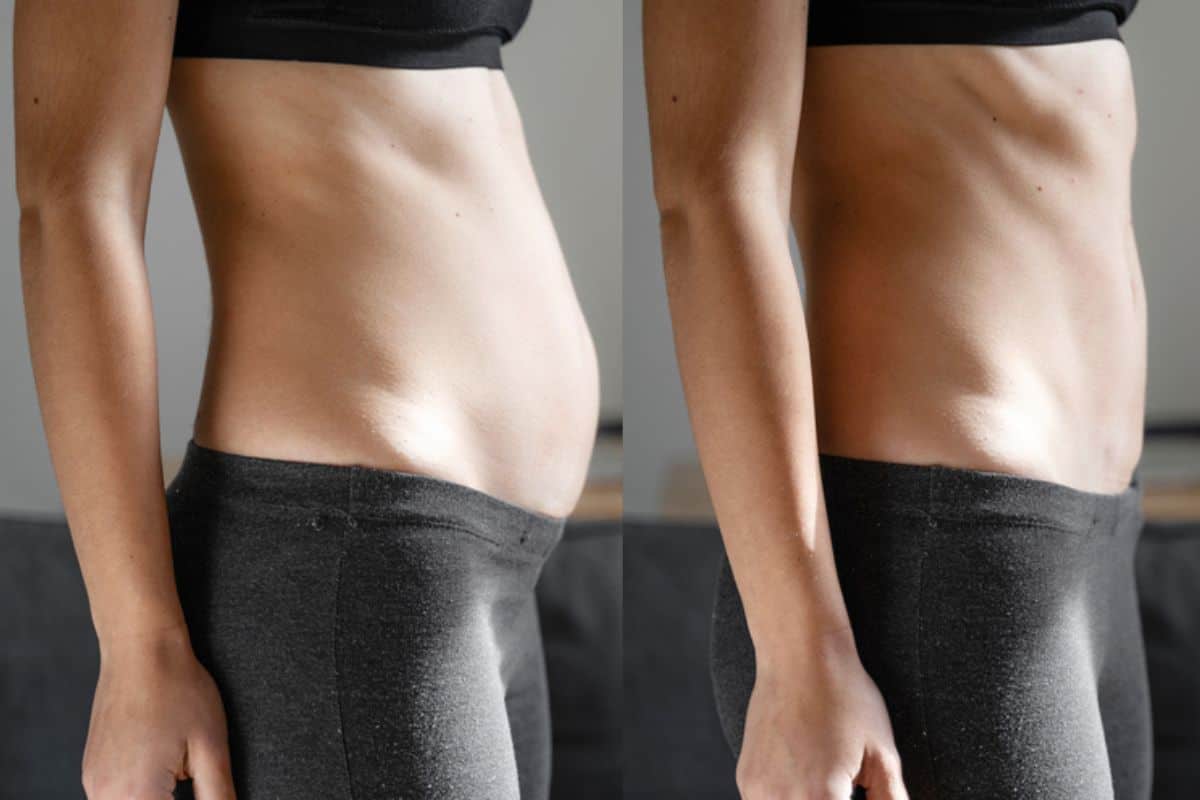 Post-Pregnancy: What Happens to Your Abdominal Muscles After Birth SCOTLAND