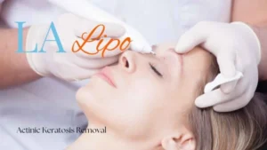 Woman receiving Actinic Keratosis Removal Treatment SCOTLAND
