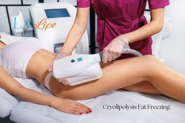 Woman receiving coolsculpting SCOTLAND treatment on her thighs