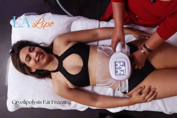 woman getting cryolipolysis SCOTLAND