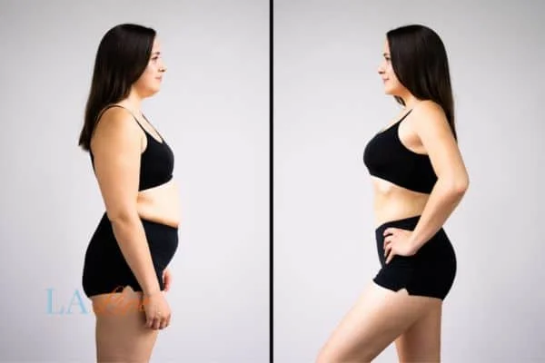 link between body image and mental health SCOTLAND