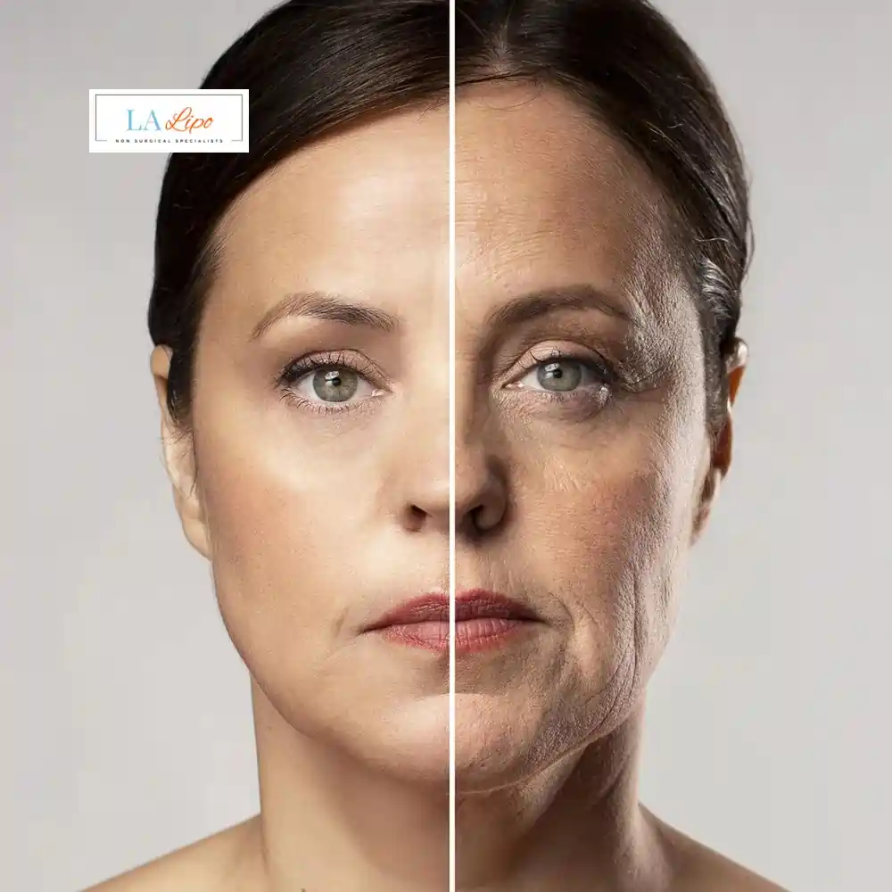 How Can You Tell If Non-Surgical Skin Tightening Is Right for You SCOTLAND?