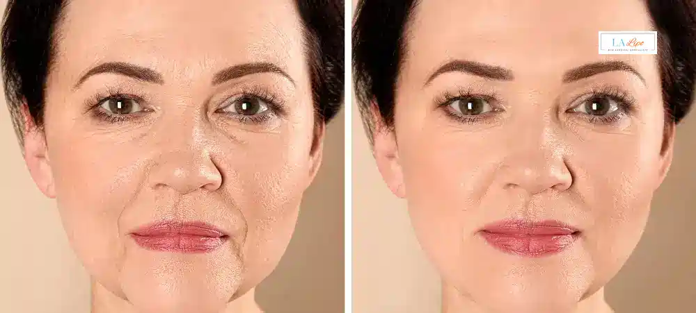 How Long Does It Take to See Results and How Long Do They Last SCOTLAND?