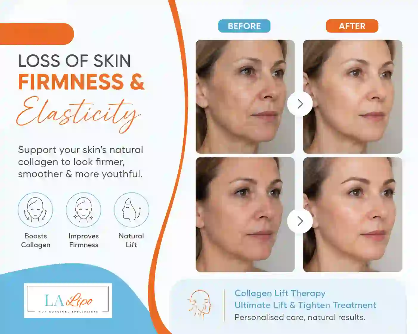Sign #7: Loss of Skin Firmness and Elasticity SCOTLAND