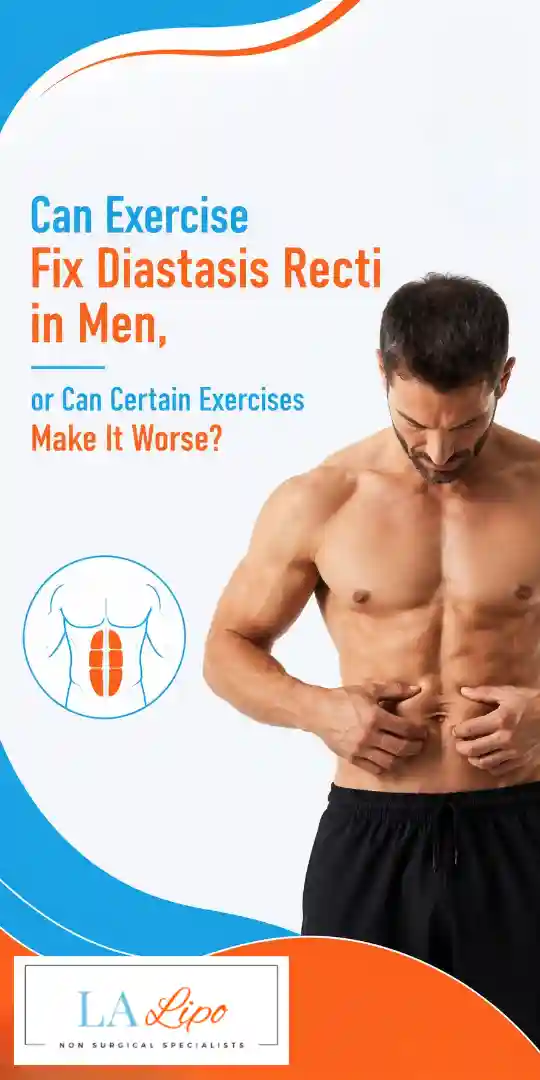 Can Exercise Fix Diastasis Recti in Men, or Can Certain Exercises Make It Worse SCOTLAND?
